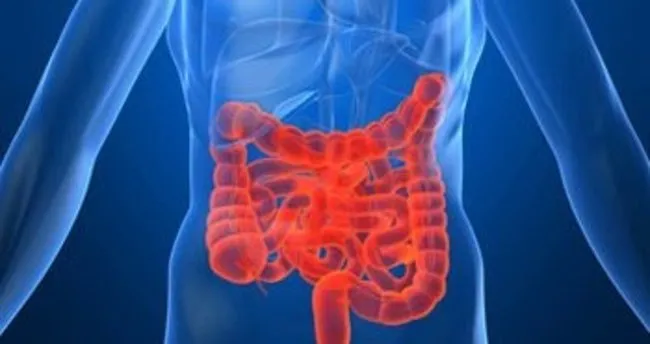 Crohn hastalığı nedir? - belirtileri nelerdir?