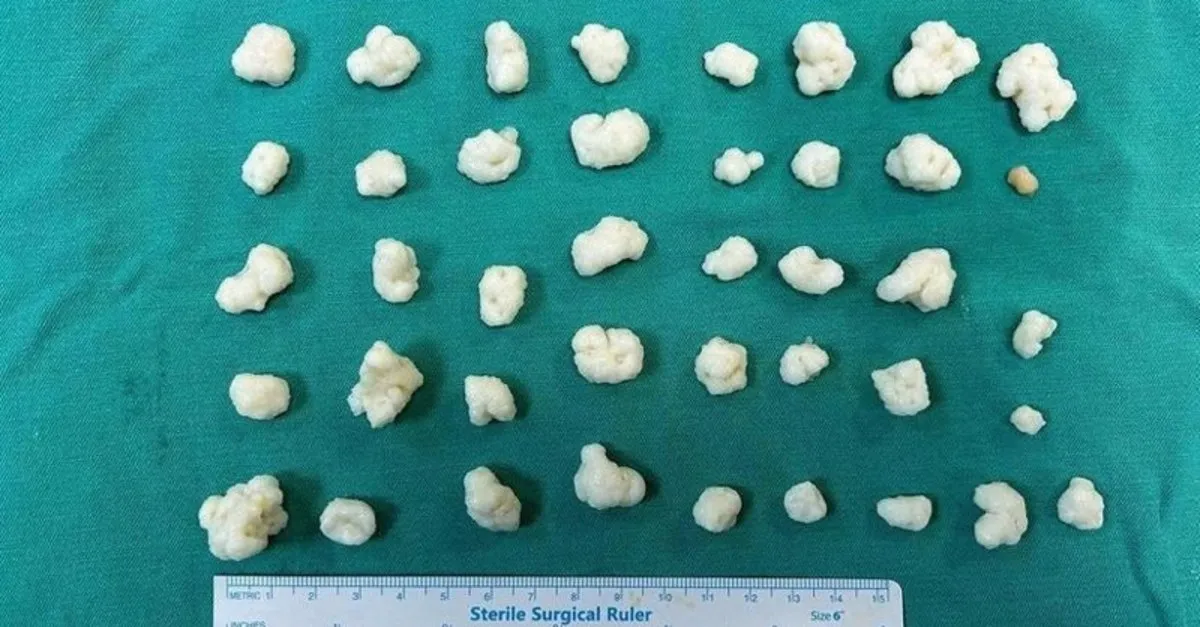 Dizinden çıkan eklem fareleri şaşırttı! Tam 41 tane...