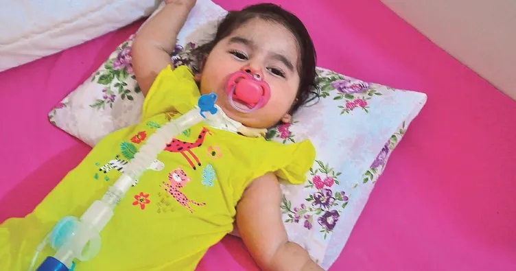 Rümeysa bebek yardım bekliyor