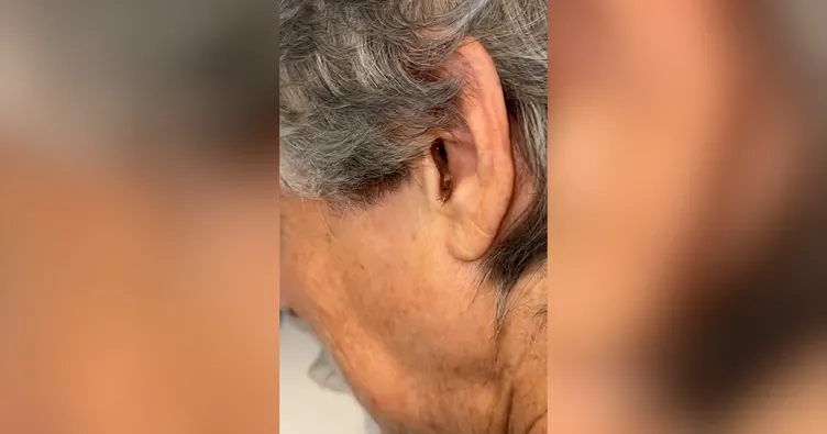 Kadının kulağından çıkana kimse inanamadı! Dehşete düşüren o görüntü...