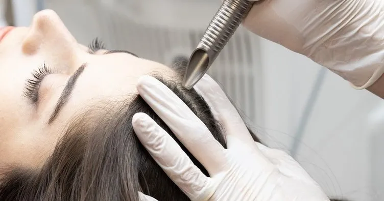 Yaz aylarında yıpranan saçlara etkili çözüm: Saç Mezoterapisi