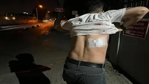 Yer yine İzmir! Taksiciye korkunç saldırı: Bir santim daha girse…