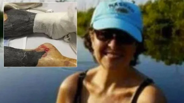 Yemeğini yedi sonra hayatını kaybetti