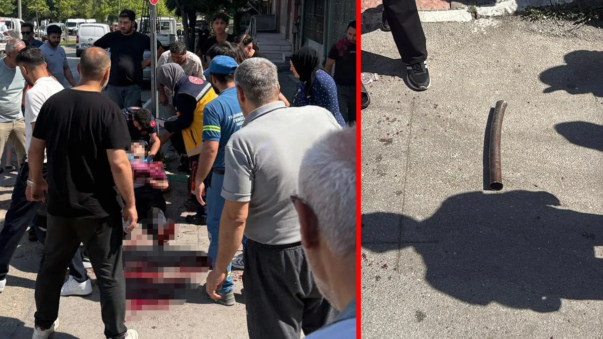Bursa'da esnaf kavgası sonrası yaralı bir babanın oğluna seslendiği an.