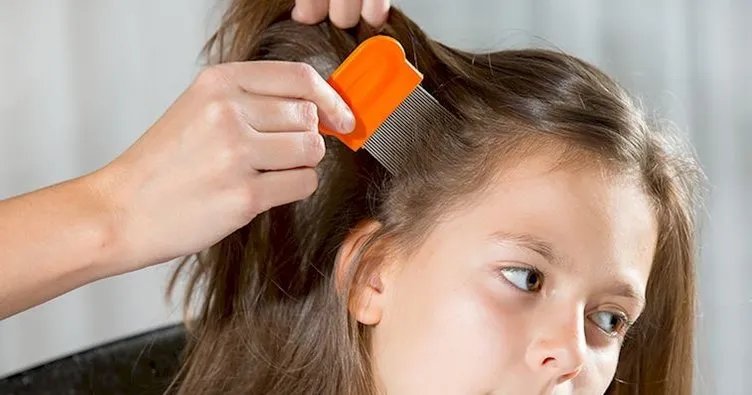 Saç biti nasıl temizlenir? Evde Doğal Yolla Ve İlaçsız Bit Temizliği Yöntemleri