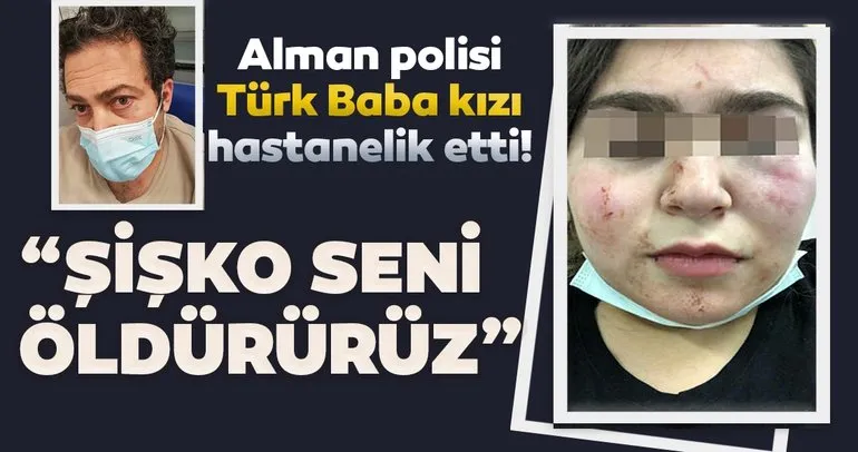 Son dakika: Almanya’da polis 17 yaşındaki Türk kızını ve babasını hastanelik etti! ’Şişko seni öldürürüz’