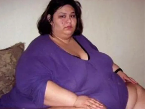 ’Yeğenini ezerek öldürdü’ haberi hayatını değiştirdi! Tam 378 kilo verdi: Dünyanın en kilolu kadını bambaşka biri oldu