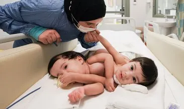 Cezayirli Siyam ikizlerini birbirinden ayıran doktorlar SABAH’a konuştu