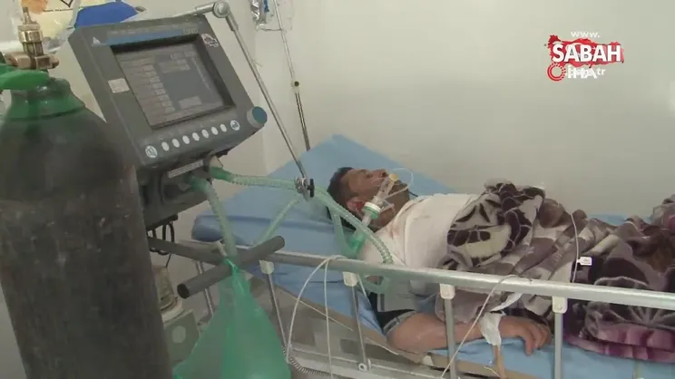 Yemen’de domuz gribinden 8 kişi öldü