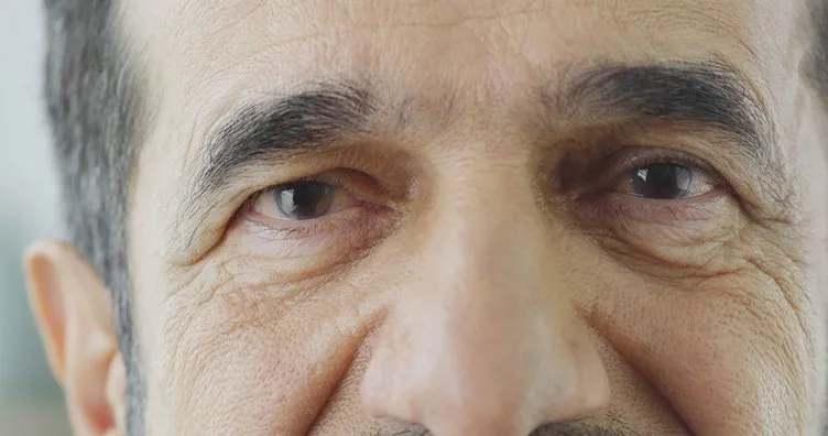 Dikkat seviyesindeki alarmın işareti! Gözlerinizde ortaya çıkan bu değişim...