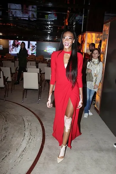 Cilt lekeleriyle ünlü olan model Winnie Harlow, Dubai'de!