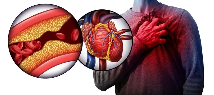 Gözlerdeki bu belirti yüksek kolesterol habercisi! Her 5 kişiden 1'ini etkiliyor…
