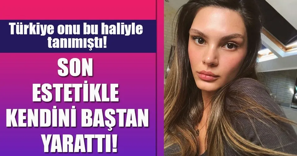 Almeda Abazi de estetik yaptırdı - Magazin Haberleri
