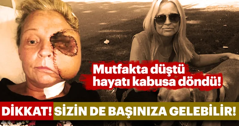 Dikkat! Sizin de başınıza gelebilir! Mutfakta düşen talihsiz kadının hayatı kabusa döndü...