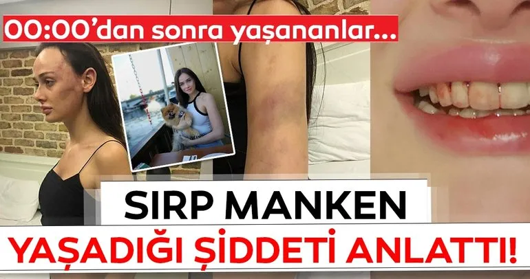 Sırp manken Tanja Dukiç’ten son dakika haberi geldi! Korkunç şiddeti böyle anlattı...