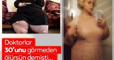 Doktorlar 30 yaşını göremeden ölürsün dedi, tam 200 kilo birden verdi! Artık o bambaşka biri…