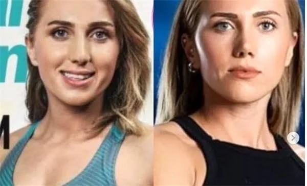 Survivor Meryem meğer estetik güzeliymiş! Meryem Kasap’ın inanılmaz değişimi takipçilerinin diline düştü!