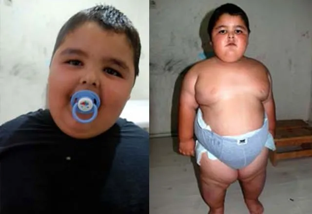 6 yaşındaki ağabeyi 42 kilo 4,5 yaşındaki Murat Can ise…