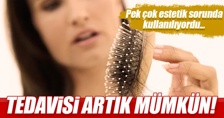 Saç dökülmesinin tedavisi artık mümkün!
