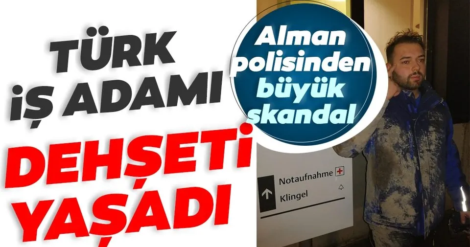 SON DAKİKA Almanya�da polis şiddeti! Türk iş adamı SON DAKİKA Almanya�da polis şiddeti! Türk iş adamı