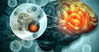 Koronavirüsten ölen insanların beyni açıldı! Sonuçlar doktorları bile şaşırttı!