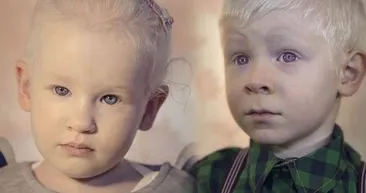 Türkiye’nin beyaz melekleri Albinolar