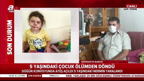 Düğün magandaları yine dehşet saçtı! 5 yaşındaki Neriman'ın yüzüne tüfek saçmaları isabet etti | Video