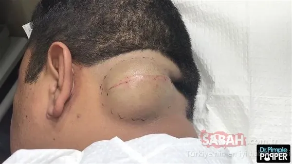 Doktora bu halde geldi! Sonrasındaysa...