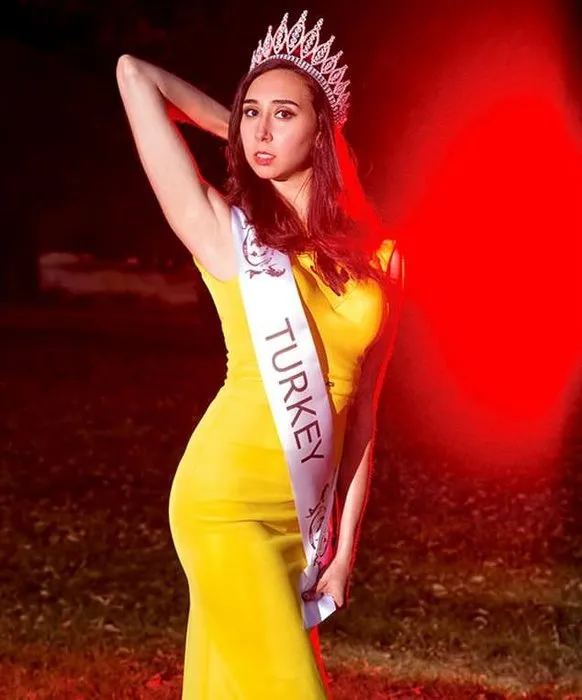 Güzellik yarışmasında derece elde edemeyen Ecem Üzgör sosyal medyayı salladı