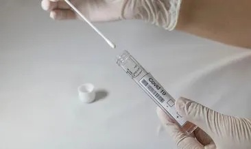 Japonya’dan çığır açan koronavirüs testi: Dakikalar içinde belli olacak