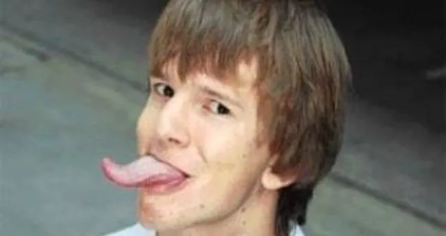 dil buyumesi neden olur