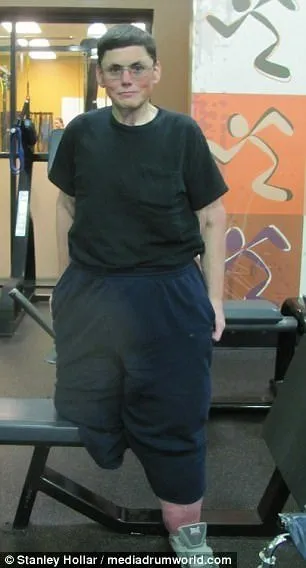 308 kiloydu! İnanılmaz değişim