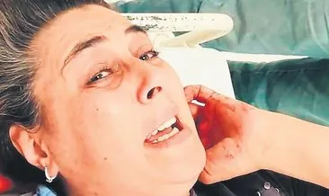 Eşini 3 yerinden bıçaklayıp serbest kaldı #konya