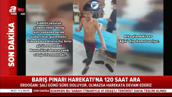 Teror Orgutu Pkk Ypg Den Kimyasal Silah Tiyatrosu Kahpelikte Sinir Tanimayan Teroristlerden Yeni Kara Propaganda Videosunu Izle Son Dakika Haberleri