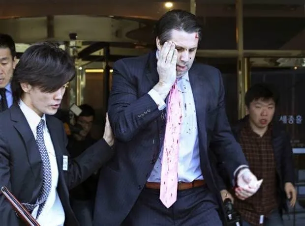 ABD’nin Seul Büyükelçisi Mark Lippert’a usturalı saldırı