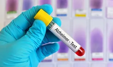 Alzheimer’ı yıllar öncesinden haber veren kan testi geliştirildi!