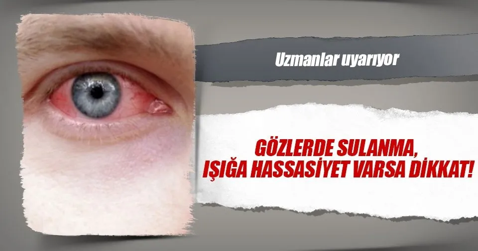 gozlerde sulanma isiga hassasiyet varsa dikkat saglik haberleri