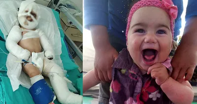 Bunun adı mucize! ‘Yaşamaz’ denilen Suriyeli Delal bebeği Türk doktorları kurtardı!