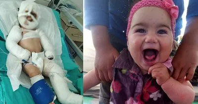 Bunun adı mucize! ‘Yaşamaz’ denilen Suriyeli Delal bebeği Türk doktorları kurtardı!