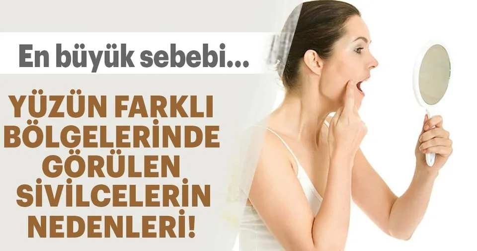 yuzun farkli bolgelerinde olusan sivilcelerin bircok nedeni var saglik haberleri yuzun farkli bolgelerinde olusan sivilcelerin bircok nedeni var saglik haberleri