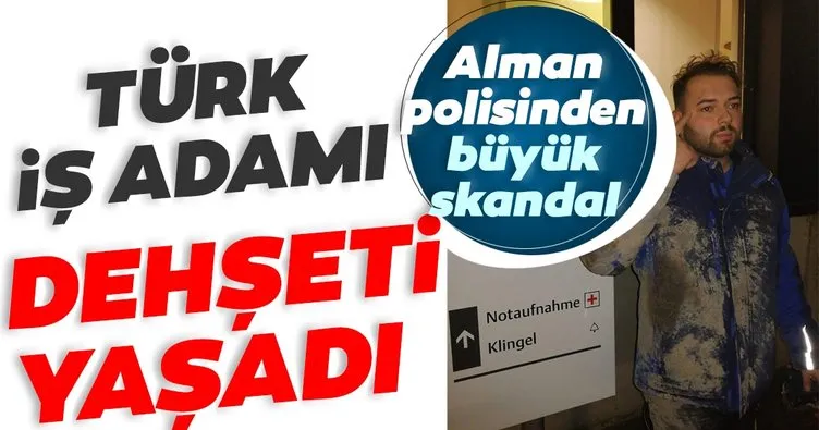 SON DAKİKA: Almanya'da polis şiddeti! Türk iş adamı dehşeti yaşadı