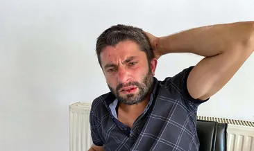 Haber takibindeki muhabire saldırı