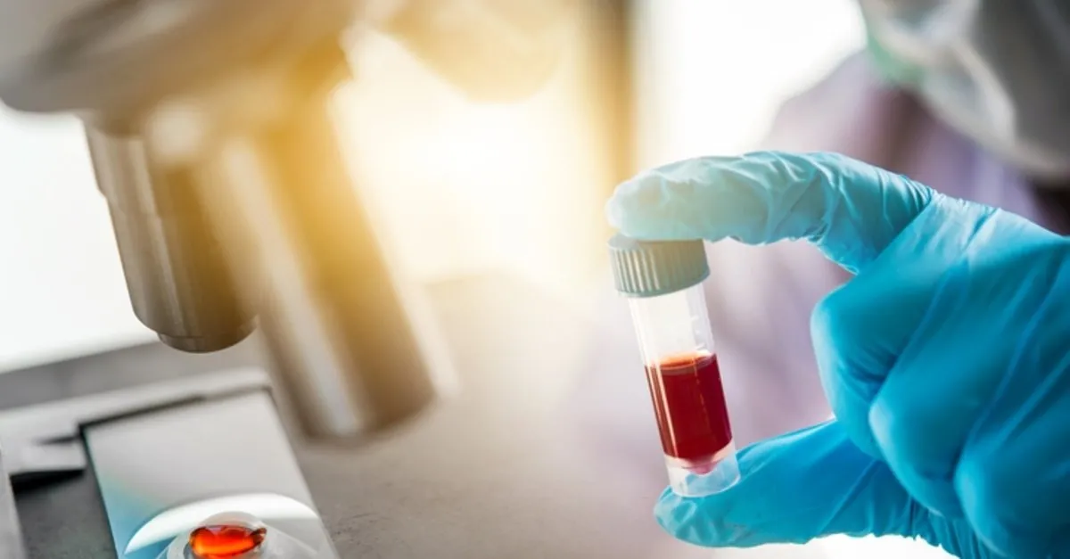 Saglik Bakanligi Antikor Testi Zorunlu Mu Hangi Hastaneler Yapiyor Antikor Testi Ne Zaman Nasil Ve Kimlere Yapilacak Son Dakika Haberler