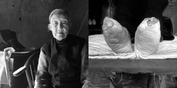 Güzellik uğruna ayaklarına öyle bir şey yaptı ki
