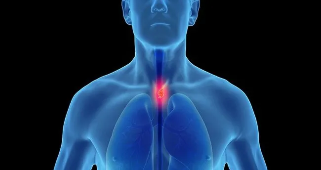 “Dünya üzerinde her gün bin kişiye lenfoma teşhisi konuluyor”