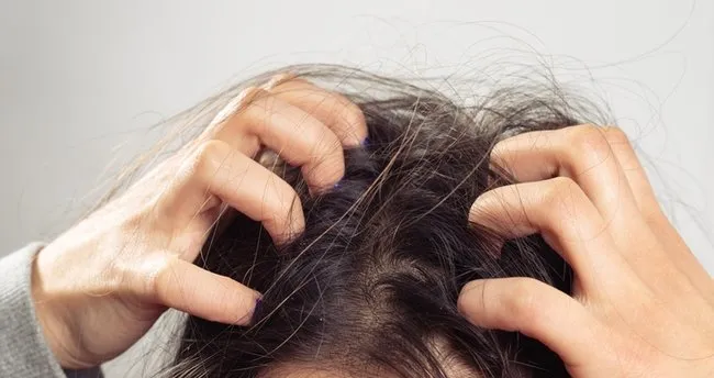 Sac Diplerindeki Kasintiya Ne Iyi Gelir Sac Dipleri Neden Kasinir Saglik Haberleri