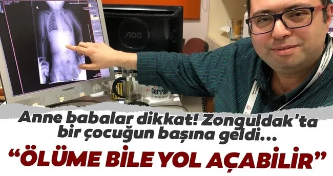 Kucuk Cocuk Madeni Para Yuttu Dogal Yolla Cikarmasi Bekleniyor Son Dakika Haberler