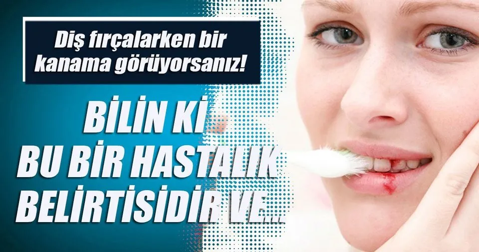 Dis Fircalarken Bir Kanama Goruyorsaniz Sayfa 4 Saglik Haberleri