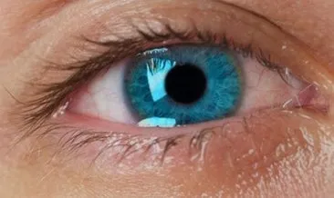 Göz Sulanması Neden Olur, Nasıl Tedavi Edilir? Göz Sulanması Neyin Belirtisi ve Sebebi Nedir, Nasıl Geçer?