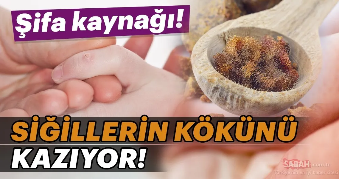 sifa kaynagi sigilleri aninda yok ediyor galeri saglik